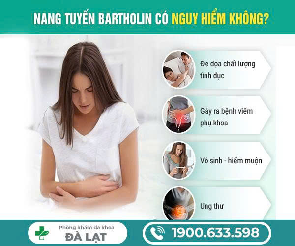 Hình ảnh minh họa